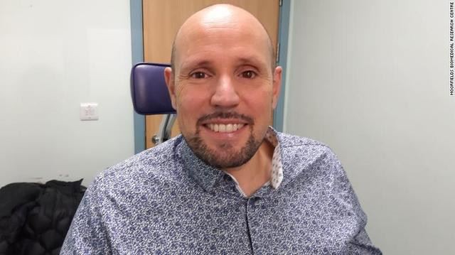 Британац инсталира прву 3Д штампану протетику ока на свету, која изгледа реал...